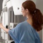 Najmoderniji mamografski uređaji za šest bolnica